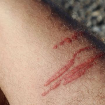 PADI Marine Life Injuries Course (Virtual Class)